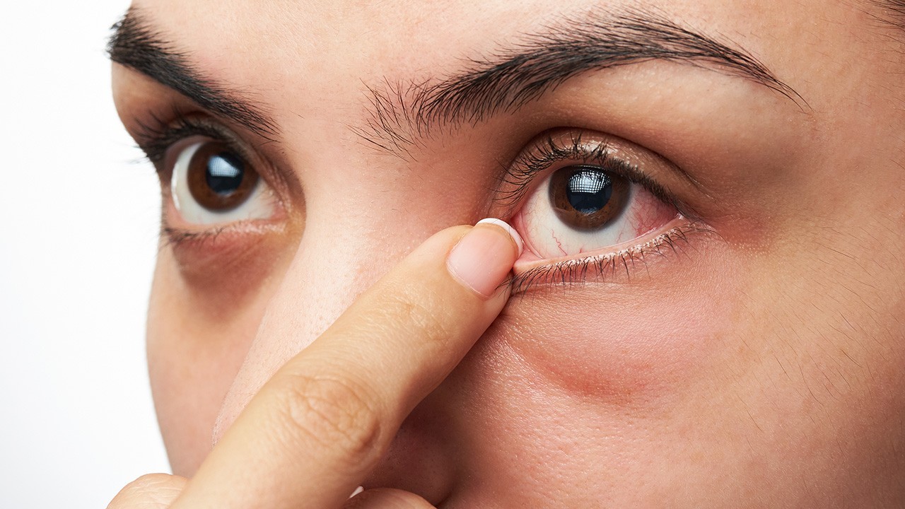 ผลไม้ฮีโร่ สู้ตาเสื่อมเบาหวาน