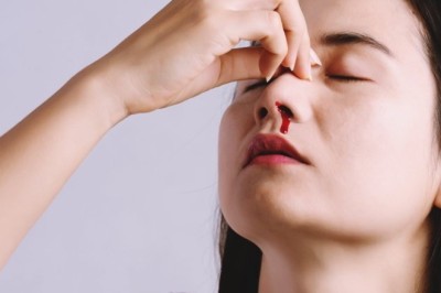 เลือดกำเดาไหลไม่ต้องกลัว