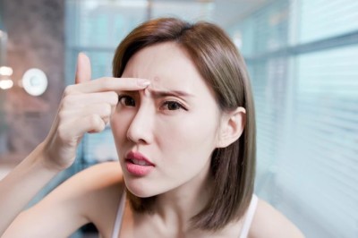 อาหารต้านสิวสำหรับคนหน้าสวย