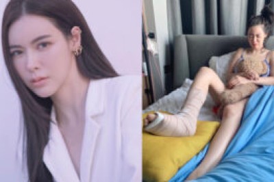 เกิดอะไรขึ้น? “ไอซ์ ปรีชญา” โพสต์ภาพเข้าเฝือกที่เท้า แฟนๆแห่ส่งกำลังใจรัวๆ