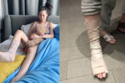 รู้แล้ว! “ไอซ์-ปรีชญา” กระดูกข้อเท้าหัก เกิดอุบัติเหตุกลางกองถ่าย