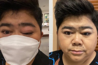 โก๊ะตี๋ อารามบอย เผยอาการหลังกินแมงป่อง-ต้องเข้ารักษาตัวในโรงพยาบาล