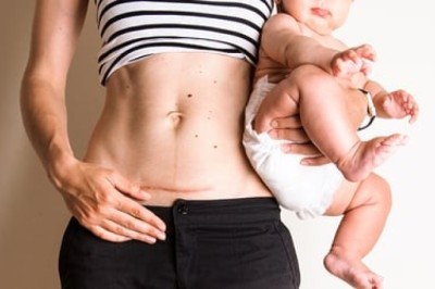 เคล็ดลับหลังคลอดหน้าท้องแบนราบ