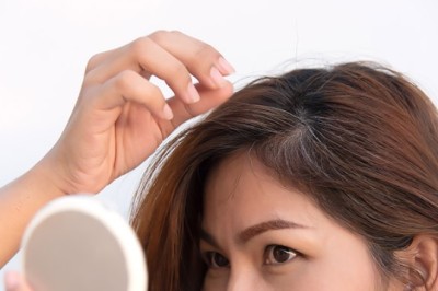 ปิดผมขาวได้ง่ายๆโดยใช้เปลือกมันฝรั่ง