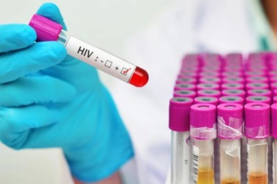 หวัดดุชนิดใหม่ชิดซ้าย เอดส์กลายพันธุ์