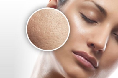 รูขุมขนกว้างก็เล็กลงได้ ง่ายนิดเดียว