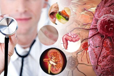 10 วิธีป้องกันมะเร็งร้ายทำลายชีวิต