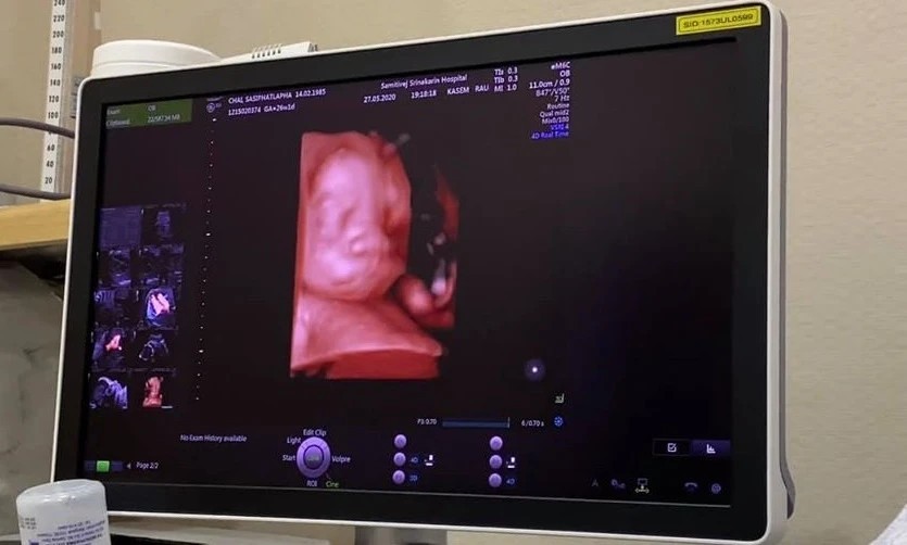 2.จอรับภาพ ( SCREEN)