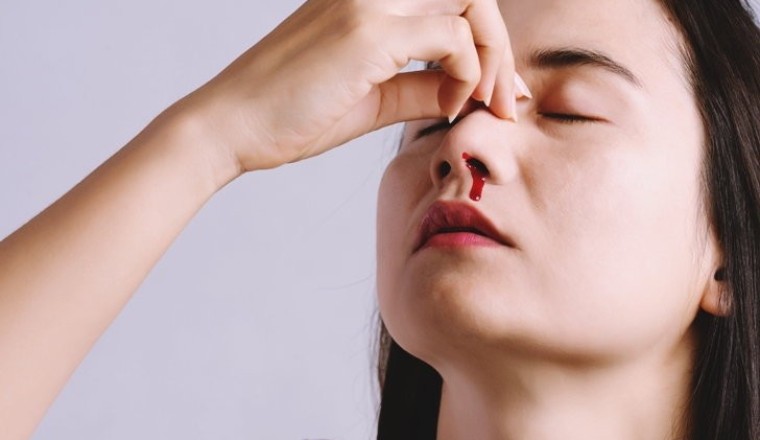 เลือดกำเดาไหลไม่ต้องกลัว