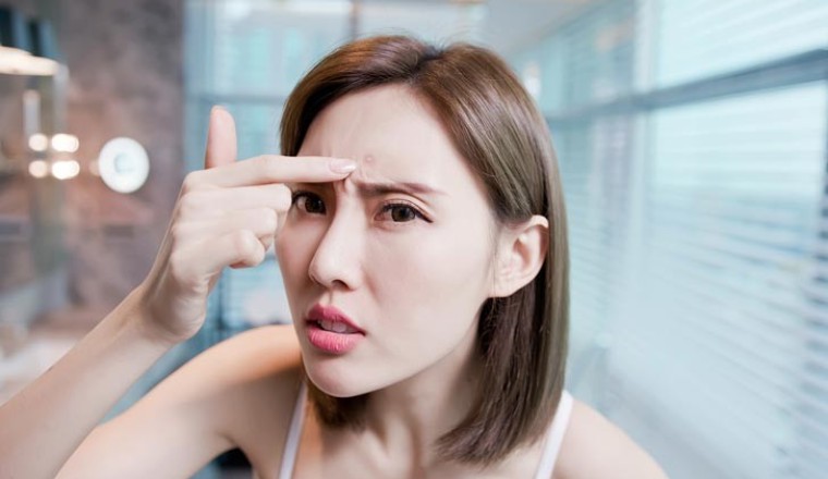 อาหารต้านสิวสำหรับคนหน้าสวย