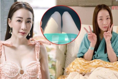 เทียบให้เห็นชัดๆ ผู้จัด ตู่ ปิยวดี เผยภาพขาขวาลีบลงหลังผ่าหัวเข่า