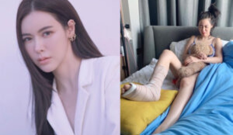 เกิดอะไรขึ้น? “ไอซ์ ปรีชญา” โพสต์ภาพเข้าเฝือกที่เท้า แฟนๆแห่ส่งกำลังใจรัวๆ