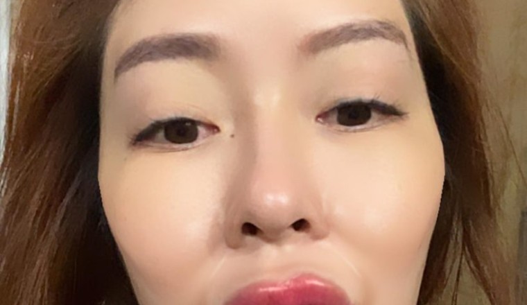 หัวใจจะวาย! แก้มบุ๋ม ปรียาดา เติมฟิลเลอร์หน้า-ปาก ใหญ่จนเห็นยันนอกโลก!