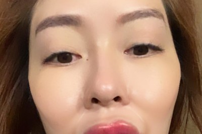 หัวใจจะวาย! แก้มบุ๋ม ปรียาดา เติมฟิลเลอร์หน้า-ปาก ใหญ่จนเห็นยันนอกโลก!