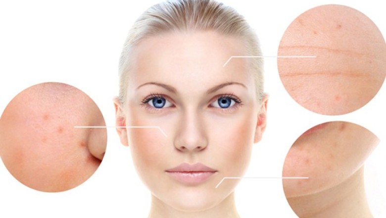 สูตรหน้าเนียนใส ไร้ฝ้า