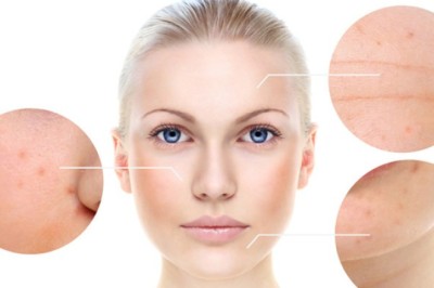 สูตรหน้าเนียนใส ไร้ฝ้า