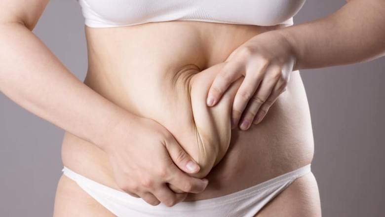 เฟิร์มหน้าท้องหลังคลอด