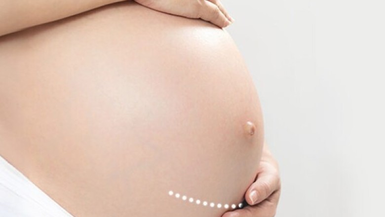 ชี้ไทยผ่าคลอดสูง ลูกเสี่ยงเป็นโรคภูมิแพ้