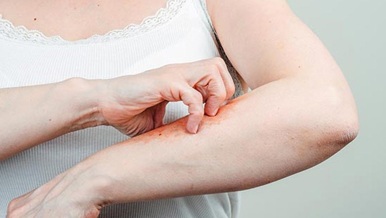 วิธีตรวจมะเร็งผิวหนังด้วยตัวเอง