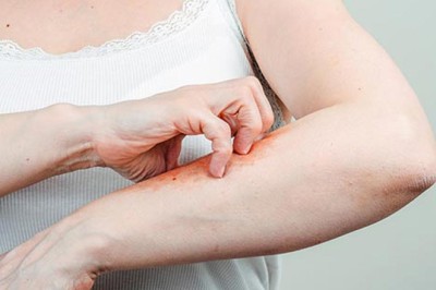 วิธีตรวจมะเร็งผิวหนังด้วยตัวเอง