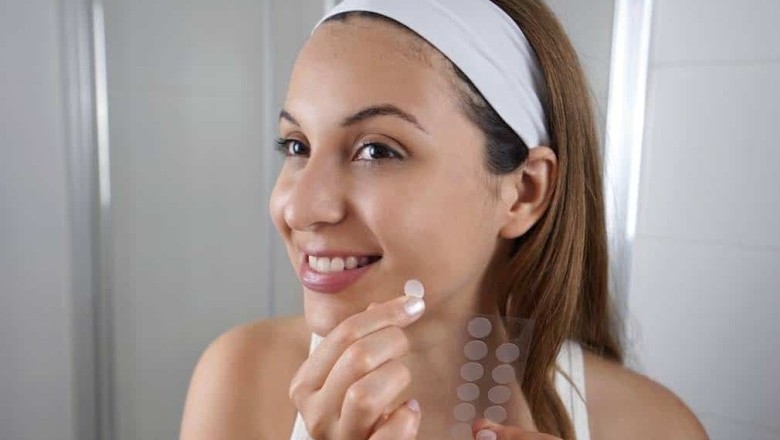 แผ่นแปะสิว ใช้ได้ผลจริงหรือไม่