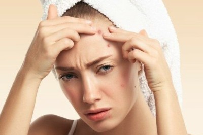 สูตรลดสิวอักเสบ สิวอุดตัน