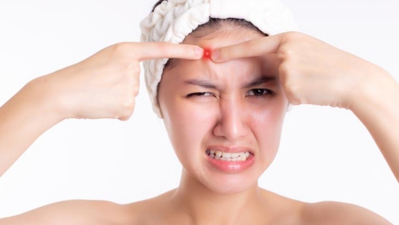 8 เคล็ดลับดูแลผิวให้สวยใสไร้สิว