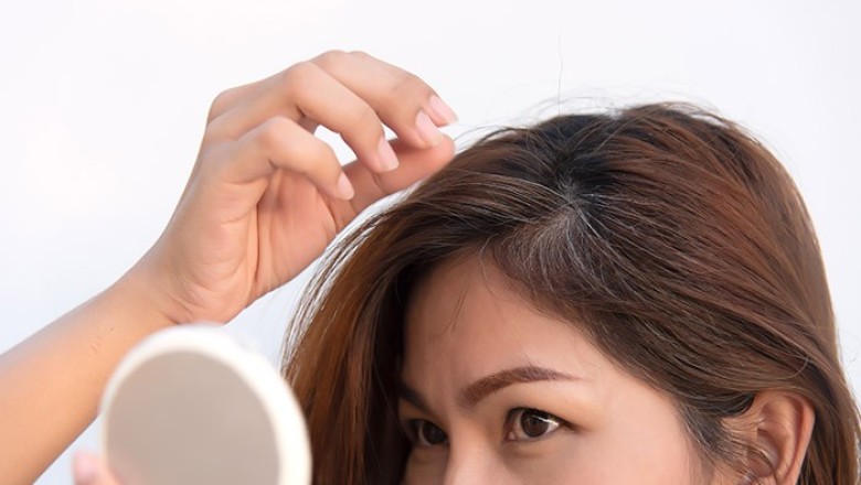 ปิดผมขาวได้ง่ายๆโดยใช้เปลือกมันฝรั่ง