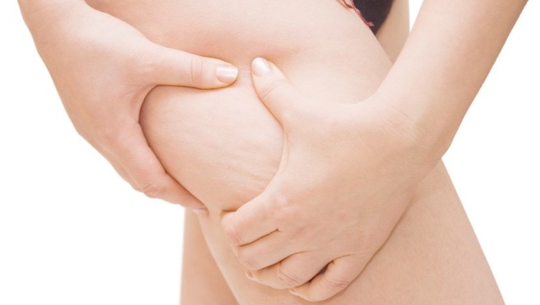 แปลงขัดผิวช่วยในการดีท็อกซ์หรือลดเซลลูไลท์ได้จริงเหรอ?