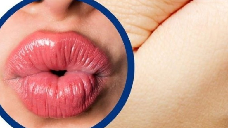 หอมหรือจูบ ไม่ได้ทำให้เกิดโรคฟันผุ