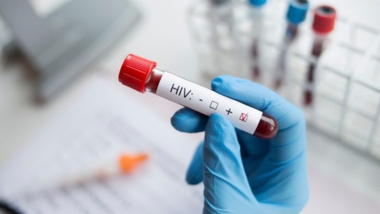 HIV ตรวจเร็ว รู้ก่อน ก้าวต่อได้