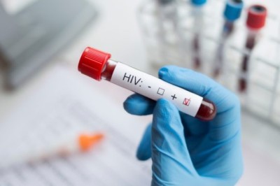 HIV ตรวจเร็ว รู้ก่อน ก้าวต่อได้