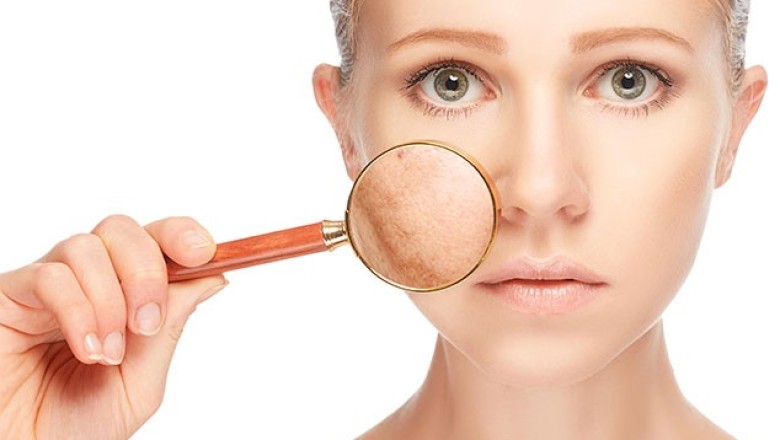 ทำความรู้จักกับ..กระแดด