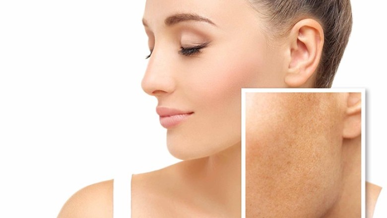 3 เคล็ดลับดูแลผิวบนใบหน้าให้สุขภาพดี ไม่มีสิวฝ้า