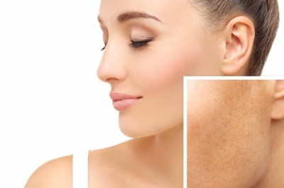 3 เคล็ดลับดูแลผิวบนใบหน้าให้สุขภาพดี ไม่มีสิวฝ้า