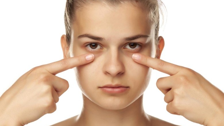 ถุงใต้ตาหลีกเลี่ยงได้ง่ายๆ