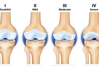 เสียงครวญจาก 