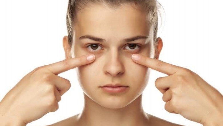 สูตรแก้ปัญหาขอบตาล่างคล้ำ