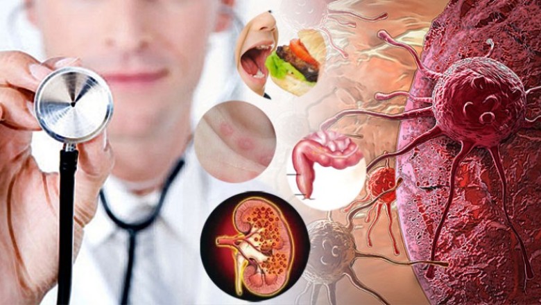 10 วิธีป้องกันมะเร็งร้ายทำลายชีวิต