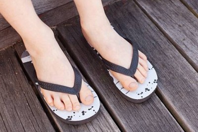 เตือนภัยรองเท้าแตะนำพาอาการเจ็บปวด