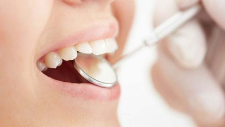 คราบหินปูนเกิดจากอะไร