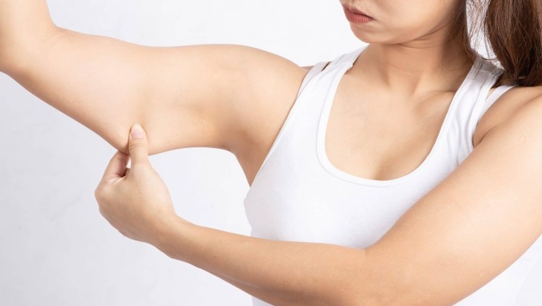 อยากใส่เสื้อแขนกุดต้องหยุดไขมันต้นแขน