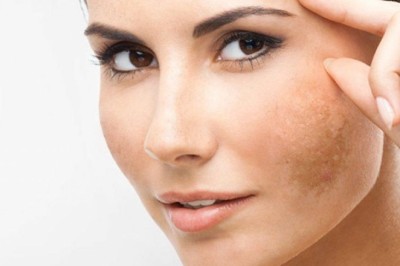 สูตรแก้ฝ้าแก้กระ