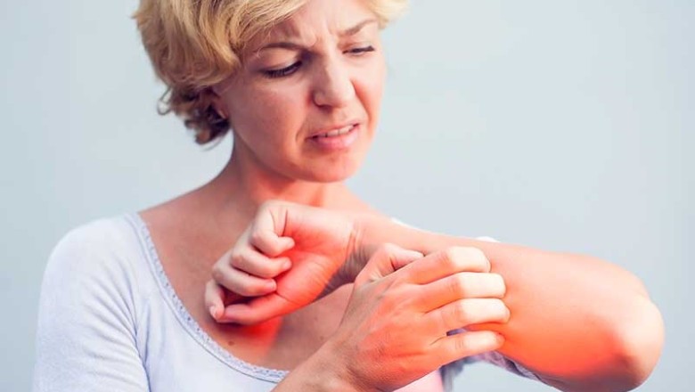 อาการแพ้อาหารแอบแฝงภัยเงียบแต่ร้ายจริง