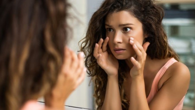 เทคนิคกำจัดถุงใต้ตาเจ้าปัญหา