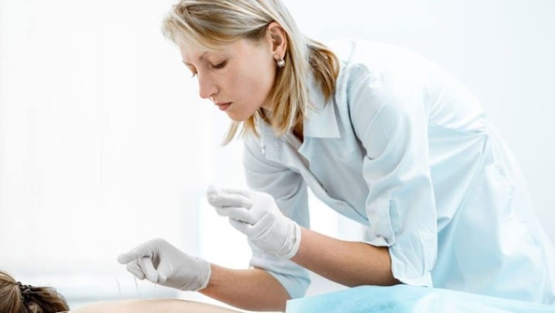 ฝังเข็มบำบัดอาการปวดหลัง