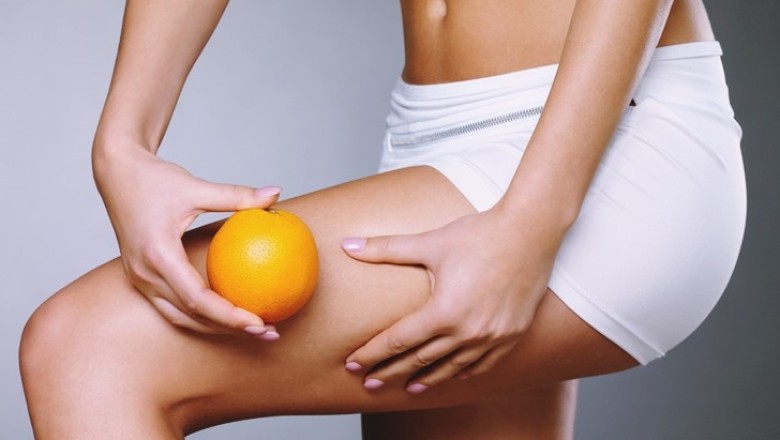 วิธีสยบเซลลูไลท์ผู้หญิงทุกคนก็ทำได้