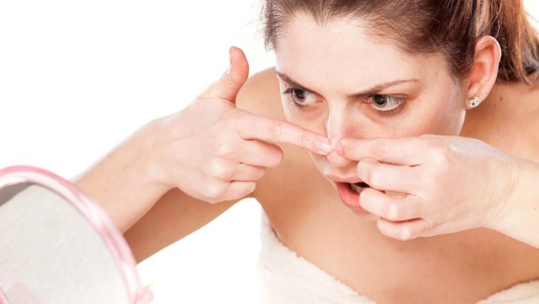 มารู้จักสิวเสี้ยนกันเถอะ