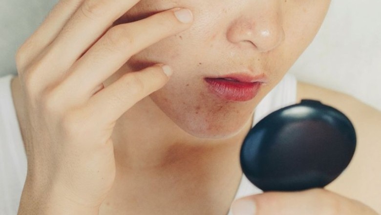 ผลิตภัณฑ์ที่ทำให้คุณมีปัญหาผิวแห้ง