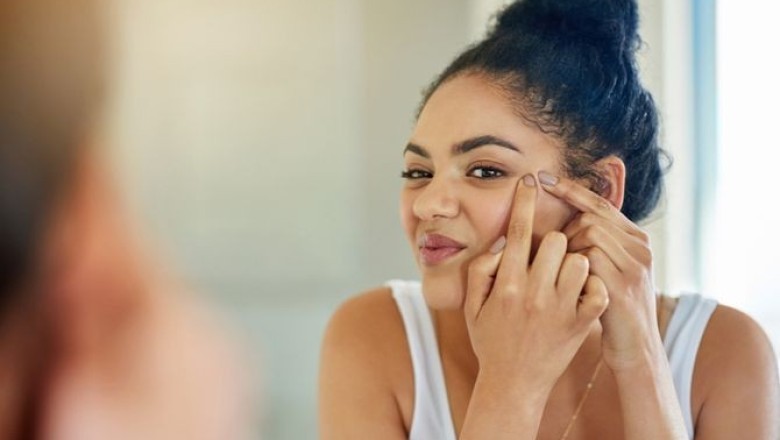 กลวิธีแก้รอยดำจากสิว